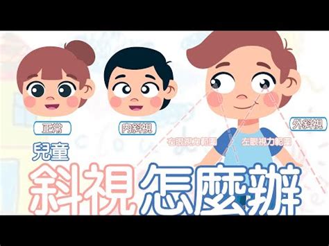 斜眼|斜視：成因與治療